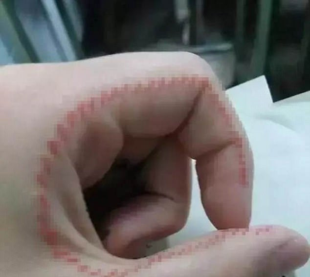 Σοκ στην Κίνα από νέο εφηβικό παιχνίδι τύπου «μπλε φάλαινας» – Ζητούν από τους παίκτες να ράψουν το δέρμα τους (εικόνες)